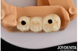 China High Aesthetics High Flexural Strength 1000 MPa Full Zirconia For Standards supplier