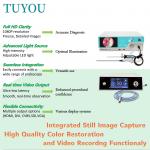 TUYOU Camera System with Rigid and Flexible Endoscopy Camera System for ENT