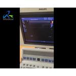 HD15 Error 0030 When Booting Ultrasound Machine Repair ACB