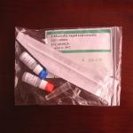 Sexually Transmitted Infection Sti Rapid Test Kit Chlamydia 98.39% for sale