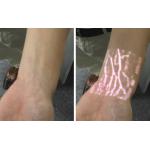 Medical Professional Infrared Vein Viewer Transilluminator Find Veins For Phlebotomy