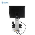 Portable Nailfold Capillary Diagnosis Microcirculation Microscope Blood Circulation