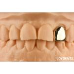 Gold 60K Metallic Oral Crown Abrasion Resistant Dental Crown Wax Casting for sale