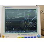 12.1 High Definition Multi Parameter Patient Monitor Vital Signs