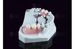 China Removable Metal Acrylic Partial Denture With Clasps For Partial Chewing supplier