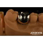 Oral Rehabilitation Wax Casting FMC Full Metal Crown For Dental Clinical Repair for sale