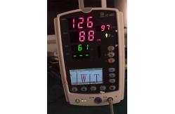 China VS800 RESP NIBP SPO2 Used Patient Monitor Mindray  Cardiac Monitor supplier
