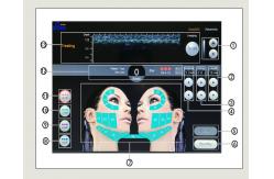 China 2 years warranty hifu  hifu hifu wrinkle removal supplier