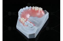 China TCS Flexible Partial Stain Resistant BPA Free Partial Dentures For Natural Look supplier