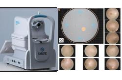 China Professional Non Mydriatic Fundus Camera For Accurate Imaging supplier