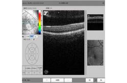 China TUV Optical Coherence Tomography Scanner Spectral Domain Machine supplier