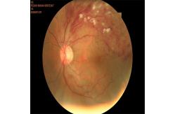 China CCD Non Mydriatic Fundus Camera Retinal Imaging No Pain supplier
