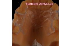 China Removable Clear Acrylic Partial Denture Clasps Retentive Natural Looking supplier