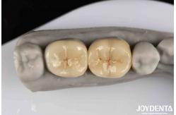 China Emax Inlay Onlay Precise Fit And Hypoallergenic Biocompatibility Easy To Clean supplier