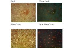 China Facial Uv Skin Analyzer Machine For Skin Mositure / Grease / Wrinkle / Pigmentation supplier