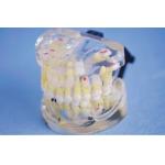 China Upper and Lower Jaw Model with Pathologies for Medical Clinic Training for sale