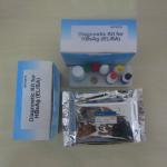 One Step 96pcs Hepatitis B Rapid Test Kit Medical Diagnostic for sale