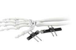 China Orthopedic Wrist External Fixator Standard Single sided Integrated supplier