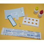 CE Marked Streptococcus Pneumoniae Rapid Strep Test Kit Antigen Diagnostic for sale