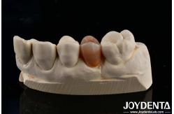 China Biocompatible And Natural-looking Multilayer Full Zirconia With Esthetics supplier