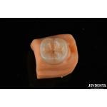 0.5mm Stain Resistant Emax Inlay Onlay Accurate Fit For Dental Restorations for sale