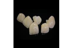 China Comfortable Zirconia Crown With Good Fitting And Precision Esthetics supplier