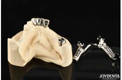 China Alloying Metal Dental Framework Removable Wearable For Dental Practitioners supplier
