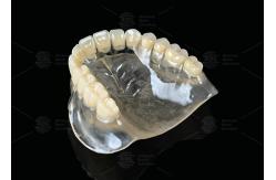 China Heat Curing Vertex Thermosens Dentures For Clear Full Denture Wearers supplier