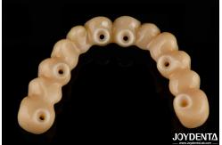 China High Flexibility Zirconia Hybrid Bridge With Titanium Base High Aesthetic supplier