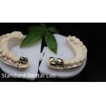 Professional ISO and FDA Approved Yellow Gold Crown for Dental Lab Shipping UPS Or Fedex Production Time 2 Days for sale