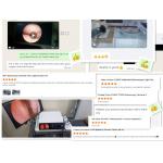 TUYOU TU-LSD90TB FHD 1080P Medical Endoscope Camera For Multi-Department Use