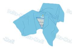 China TUR Surgical Disposable Sterile Urology Drape / Lithotomy Drape With Aperture / Pouch supplier