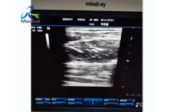 China Abnormal Image Ultrasound Machine Repair Service Mindray DC-3 supplier
