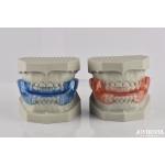 Custom Fitting Sleeping Aid Mouthpieces Dental Appliance To Stop Snoring for sale