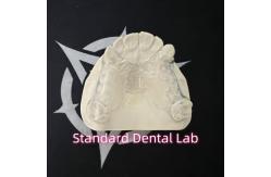 China Removable Cast Clear Framework Partial Easy To Clean And Take Off supplier