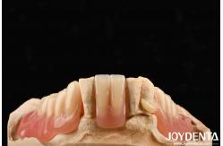 China Lightweight Good Biocompatibility Acrylic Denture Finish Personalized Customization In Medical Equipment supplier