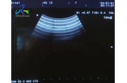 China Aloka ASU-1010 Ultrasound Transducer Probe Replace Housing Cover And Crystal supplier