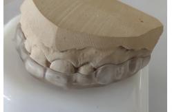 China Esthetics Lower Arch Mouth Piece For Teeth Clenching supplier