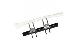 China Orthopedic Surgical External Fixation Device Wrist supplier