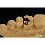 Clinical Metallic Dental Gold Crown 60K Gold Tooth Cap For Oral Rehabilitation for sale