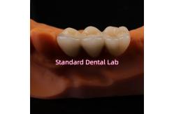 China Digital CAD CAM Dental Lab Crowns Translucent Layered Zirconia Crown supplier