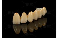 China Strong Aesthetic Porcelain Fused To Zirconia For Natural Looking Restorations supplier