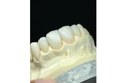 China Transluency Layered Zirconia Crown for Optimal Functionality and Natural Aesthetics supplier