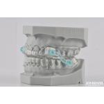 Custom Fitting Sleeping Aid Mouthpieces Dental Appliance To Stop Snoring