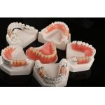 Hypoallergenic Acrylic Dental Removables Artificial Teeth Removable Partial Denture for sale