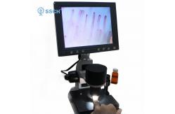 China Capillaroscope Microcirculation Microscope Built - In Camera 380 000 Pixels GY-3880 supplier