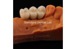 China Digital CAD CAM Dental Lab Crowns Translucent Layered Zirconia Crown supplier