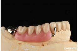 China Elaborate Framework Final Set Stable Dental Structure Designed Teeth Finish supplier