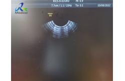 China GE RIC5-9-D Ultrasound Probe Repair 4D Replace Dome And Crystal Array supplier