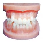 China Dental implant models / Orthodontic Model for Anatomical Training for sale